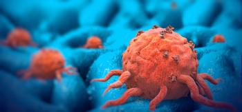 Updates in Renal Cell Carcinoma Management