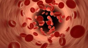 STArT Trial Raises Questions About How Acute Sickle Cell Pain Trials Measure Treatment Success
