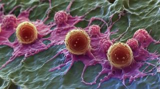 Optimizing Tacrolimus Levels in Post-Transplant Cyclophosphamide: A Pharmacist-Led Study on Outcomes and Toxicity Management