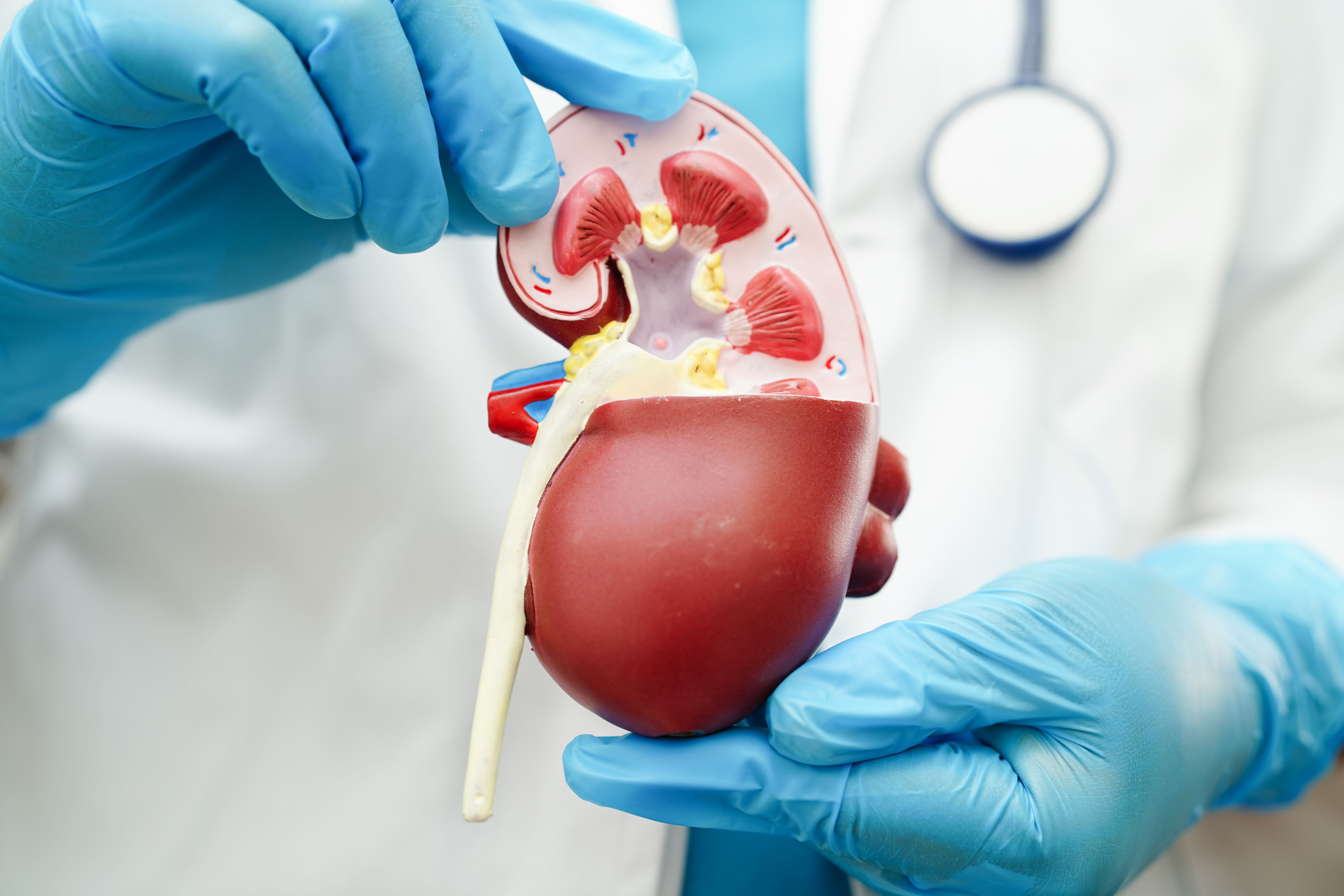 Chronic kidney disease (CKD) -- Image credit: manassanant | stock.adobe.com