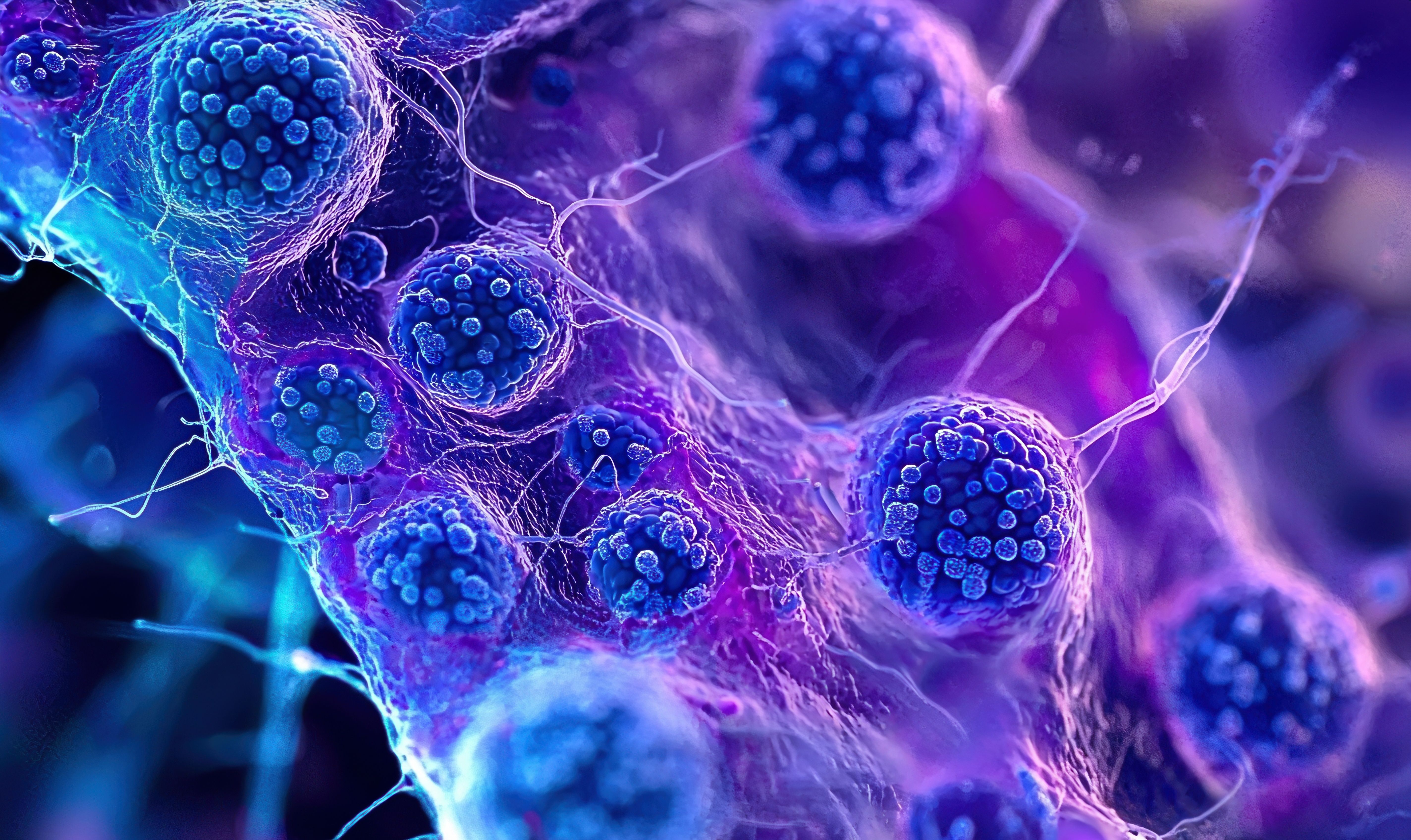 Microscopic illustration of follicular lymphoma | Image Credit: © FocusFusion - stock.adobe.com