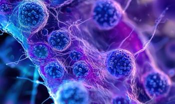 Microscopic illustration of follicular lymphoma | Image Credit: © FocusFusion - stock.adobe.com