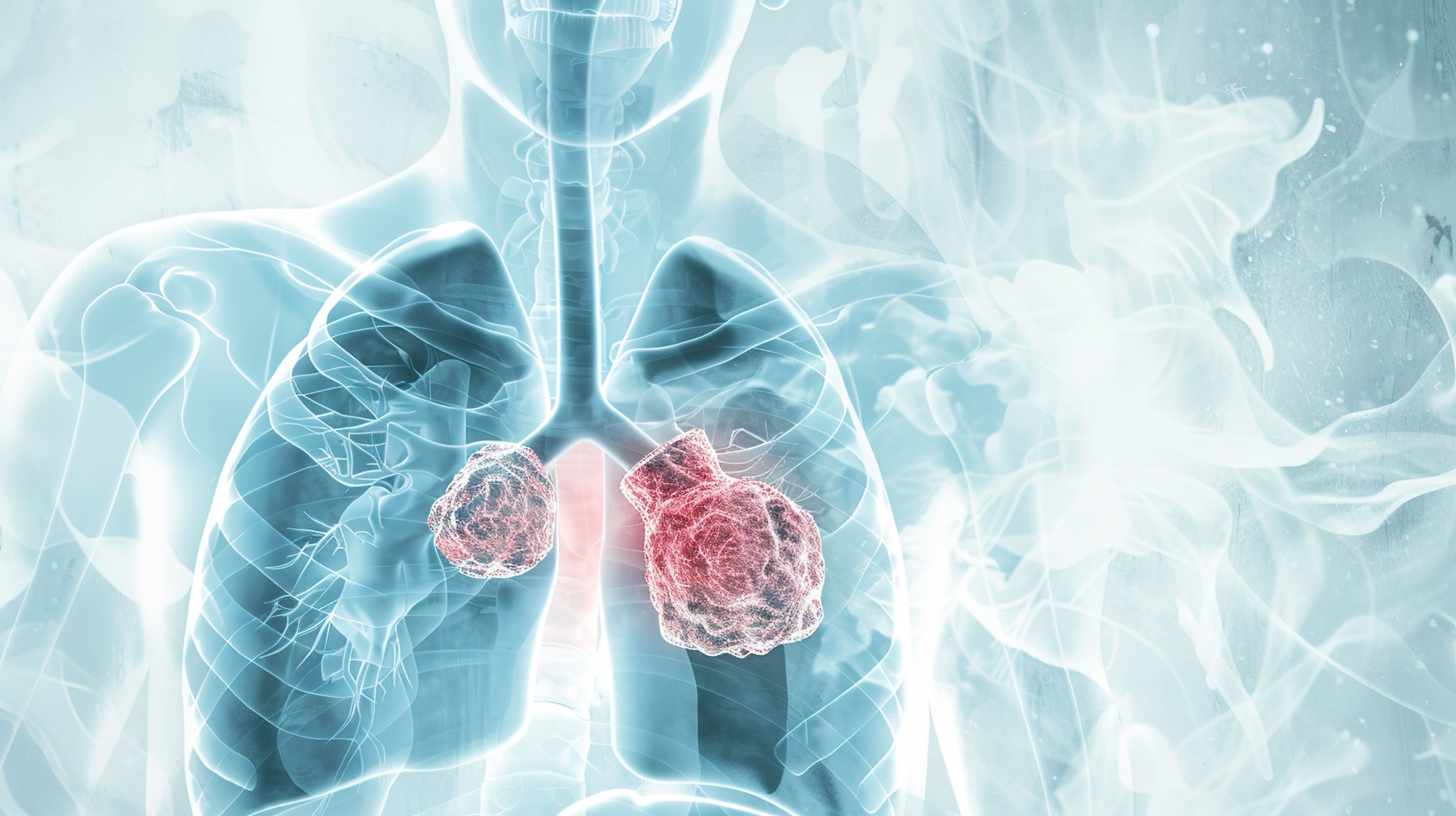 Lung cancer combined with detailed human thoracic anatomy | Image Credit: Ba | stock.adobe.com