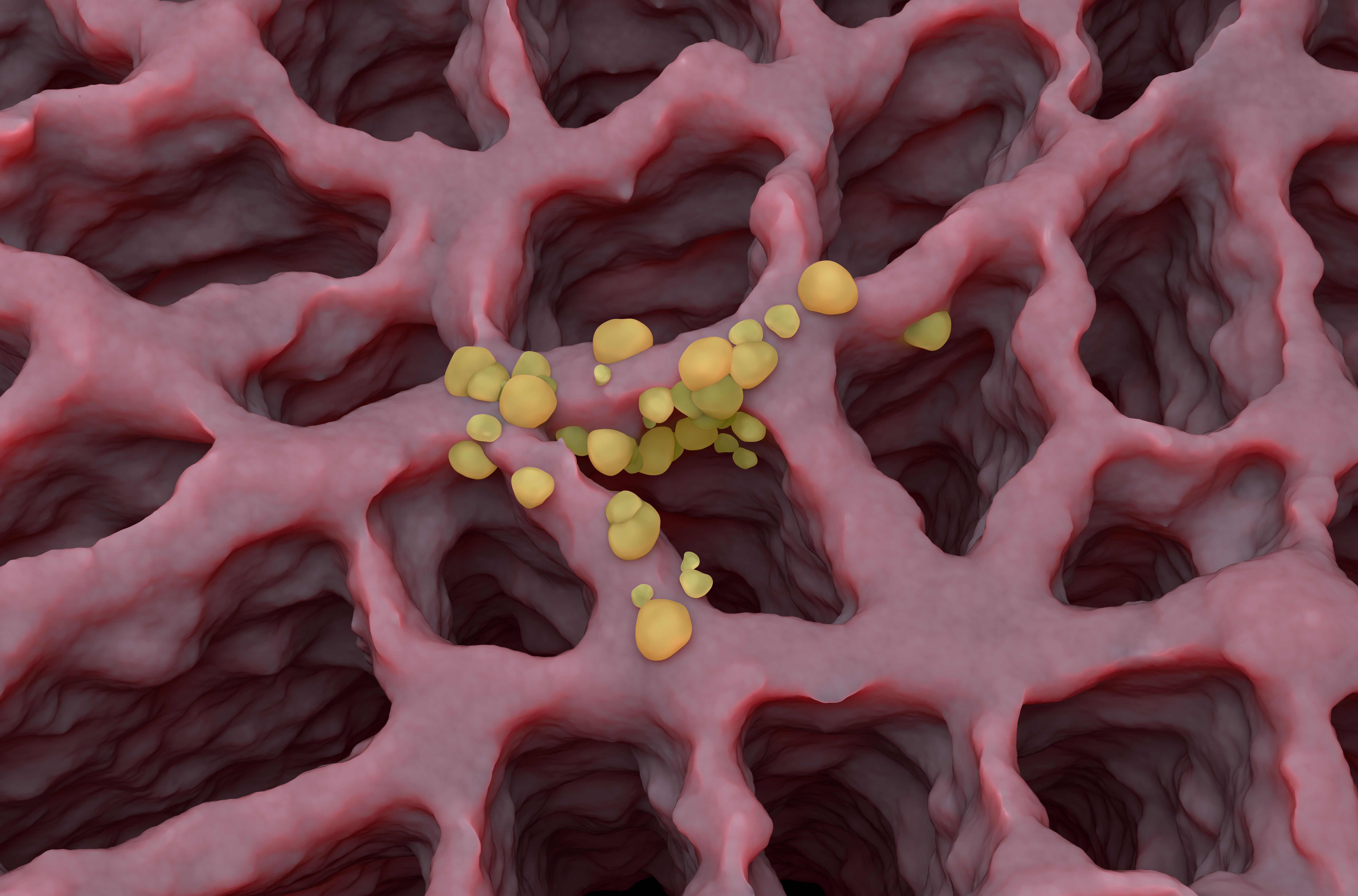 Small cell lung cancer -- Image credit: LASZLO | stock.adobe.com