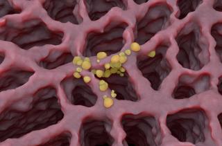 Small cell lung cancer -- Image credit: LASZLO | stock.adobe.com