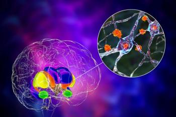 Dorsal striatum and its neurons in the Huntington's disease, 3D illustration