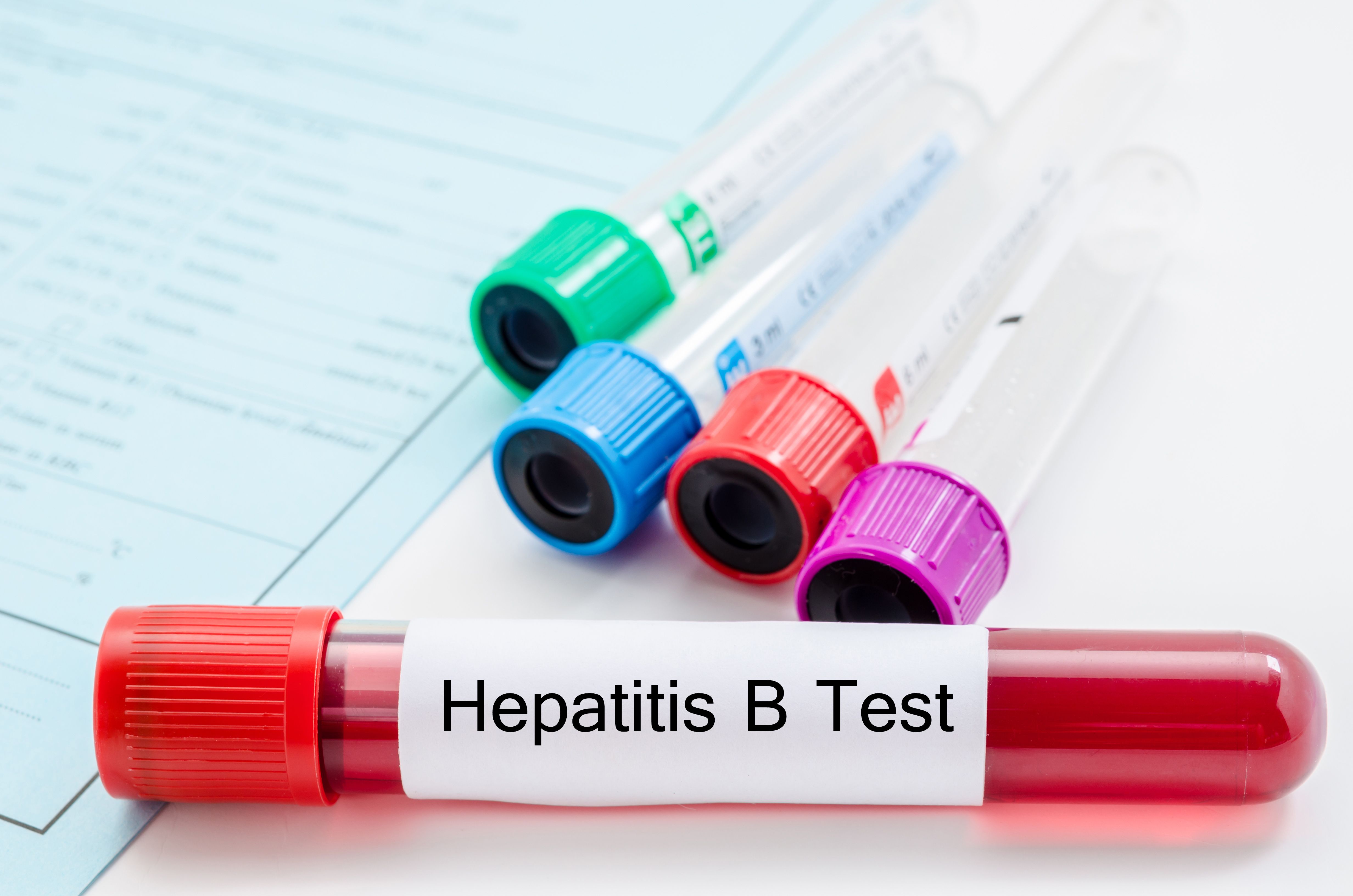 Blood sample testing for hepatitis B virus -- Image credit: gamjai | stock.adobe.com