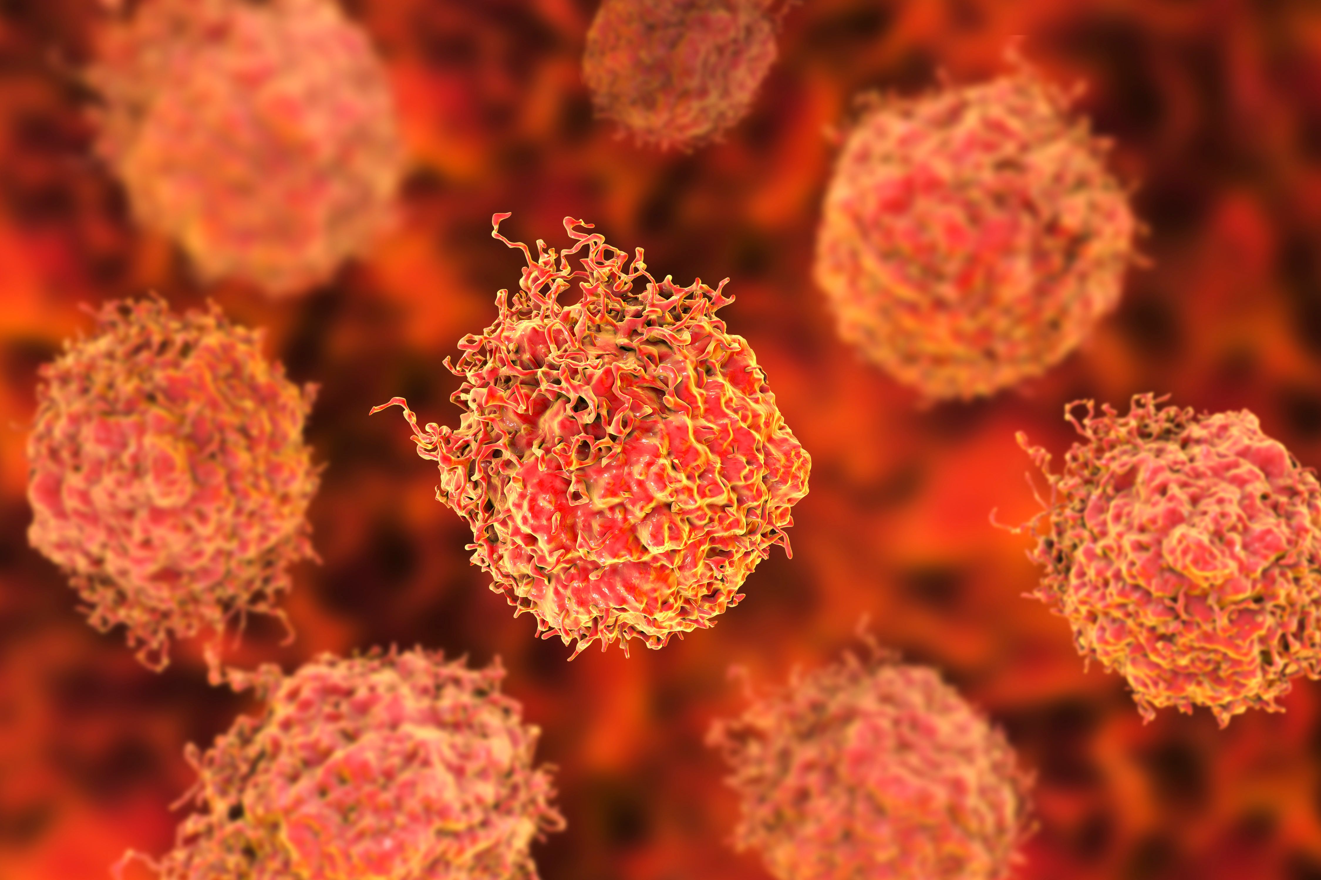 Prostate cancer cells | Image Credit: © Dr_Microbe - stock.adobe.com