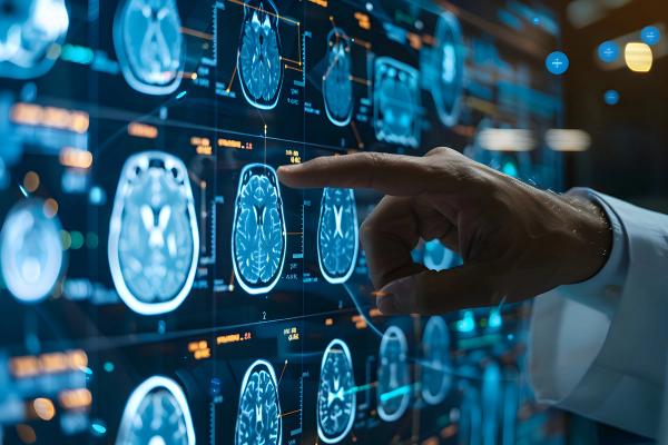 Cenrifki Becomes First EU-Approved Therapy Targeting Disability Progression in Nonrelapsing SPMS