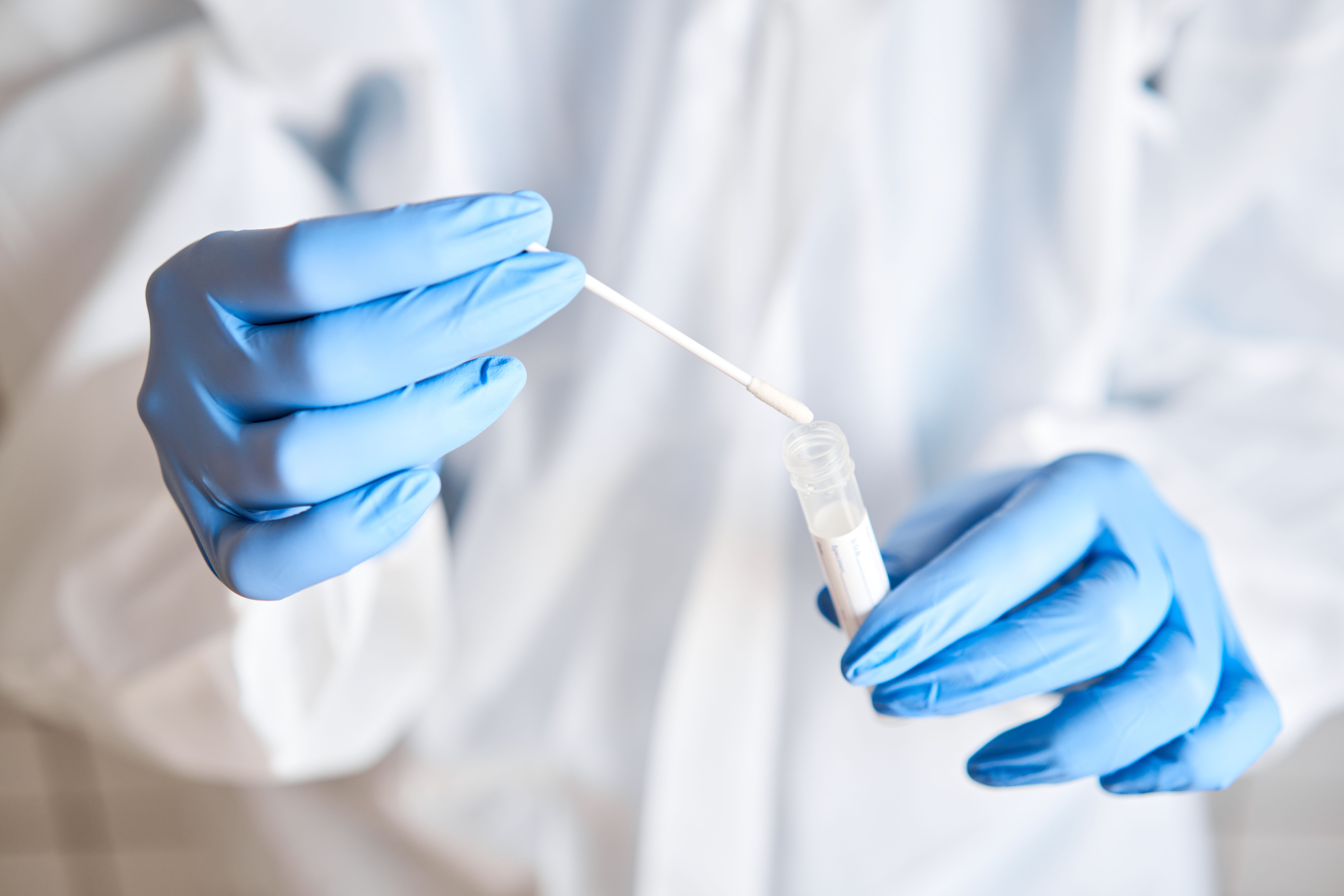 Doctor holding swab test tube for 2019-nCoV analyzing. Coronavirus test. Blue medical gloves and protective face mask for protection against covid-19 virus. Coronavirus and pandemic - Image credit: malkovkosta | stock.adobe.com