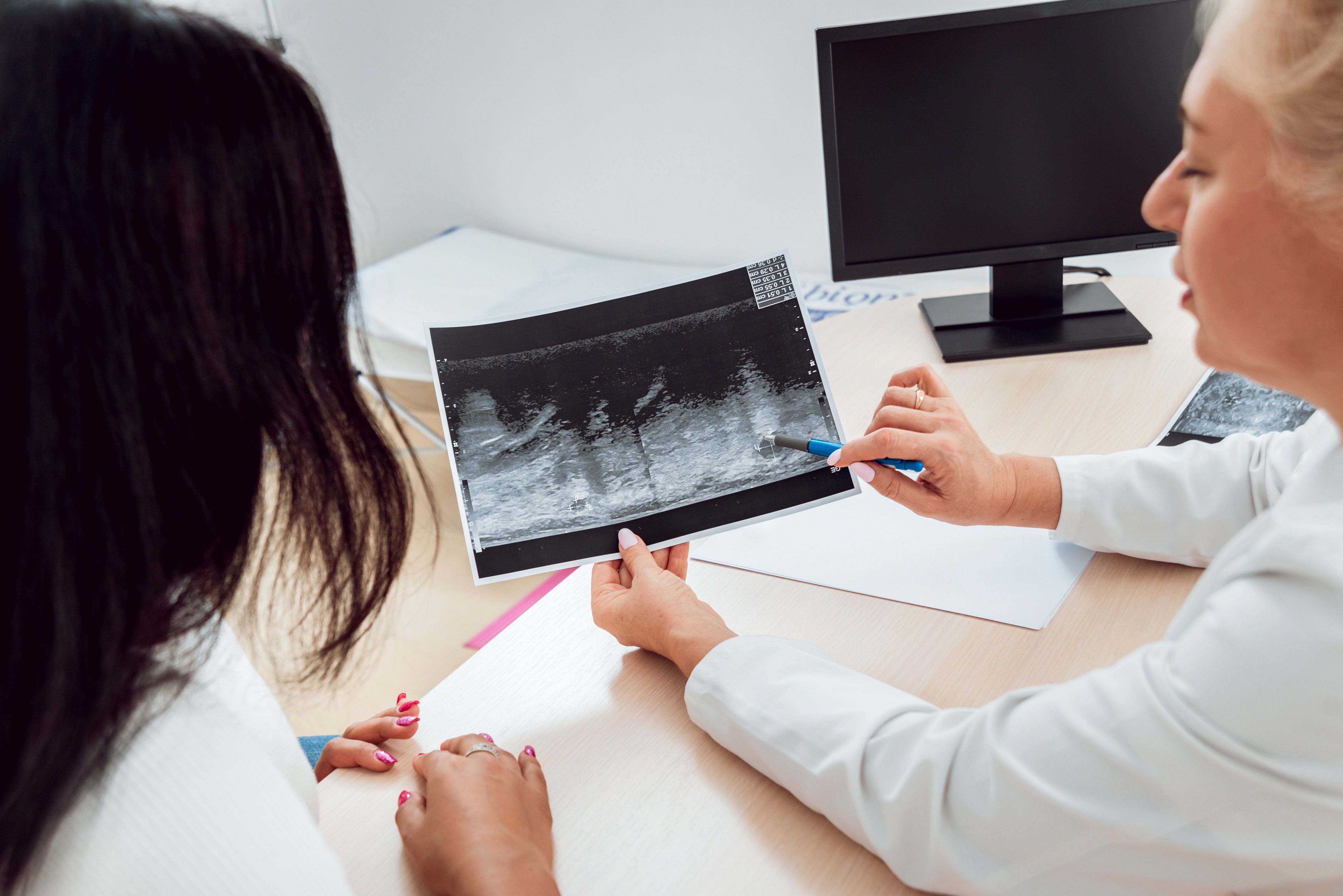 Physician discussing mammogram with a patient