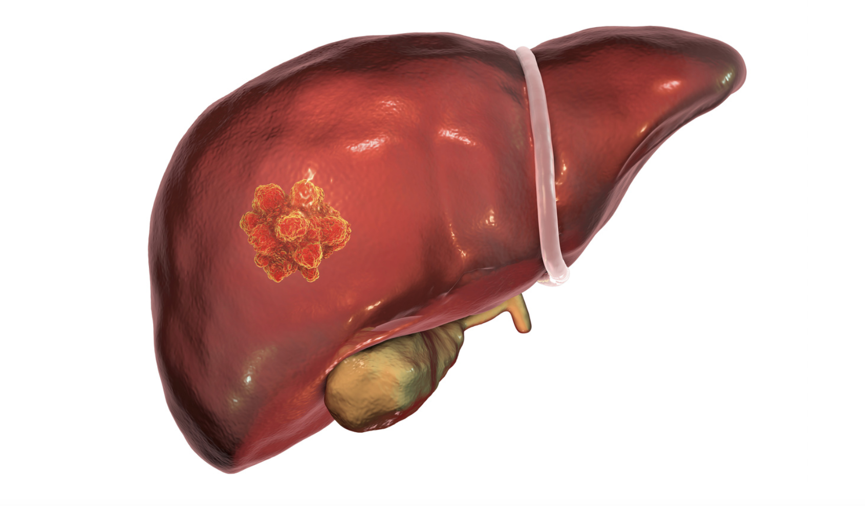 Картинки HEPATITIS LIVER
