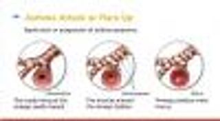 Treatments and Symptoms of Asthma in Children