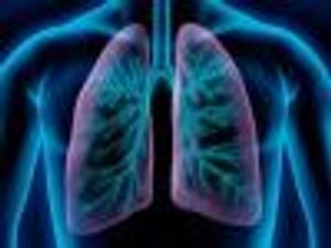 New Study Highlights Factors Linked to Lower Lung Cancer Risk in Patients with COPD