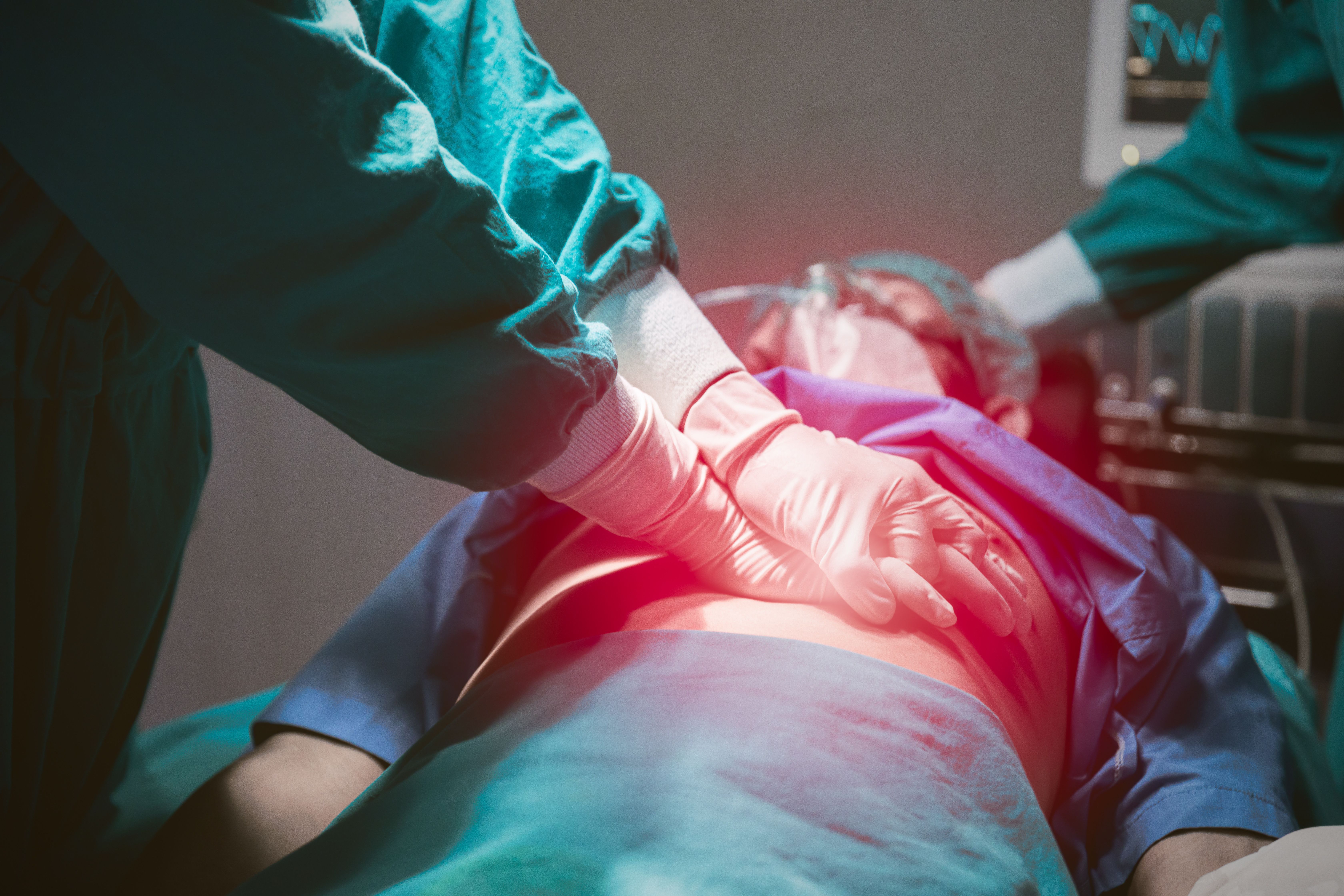 Patient having cardiac arrest in hospital -- Image credit: Quality Stock Arts | stock.adobe.com