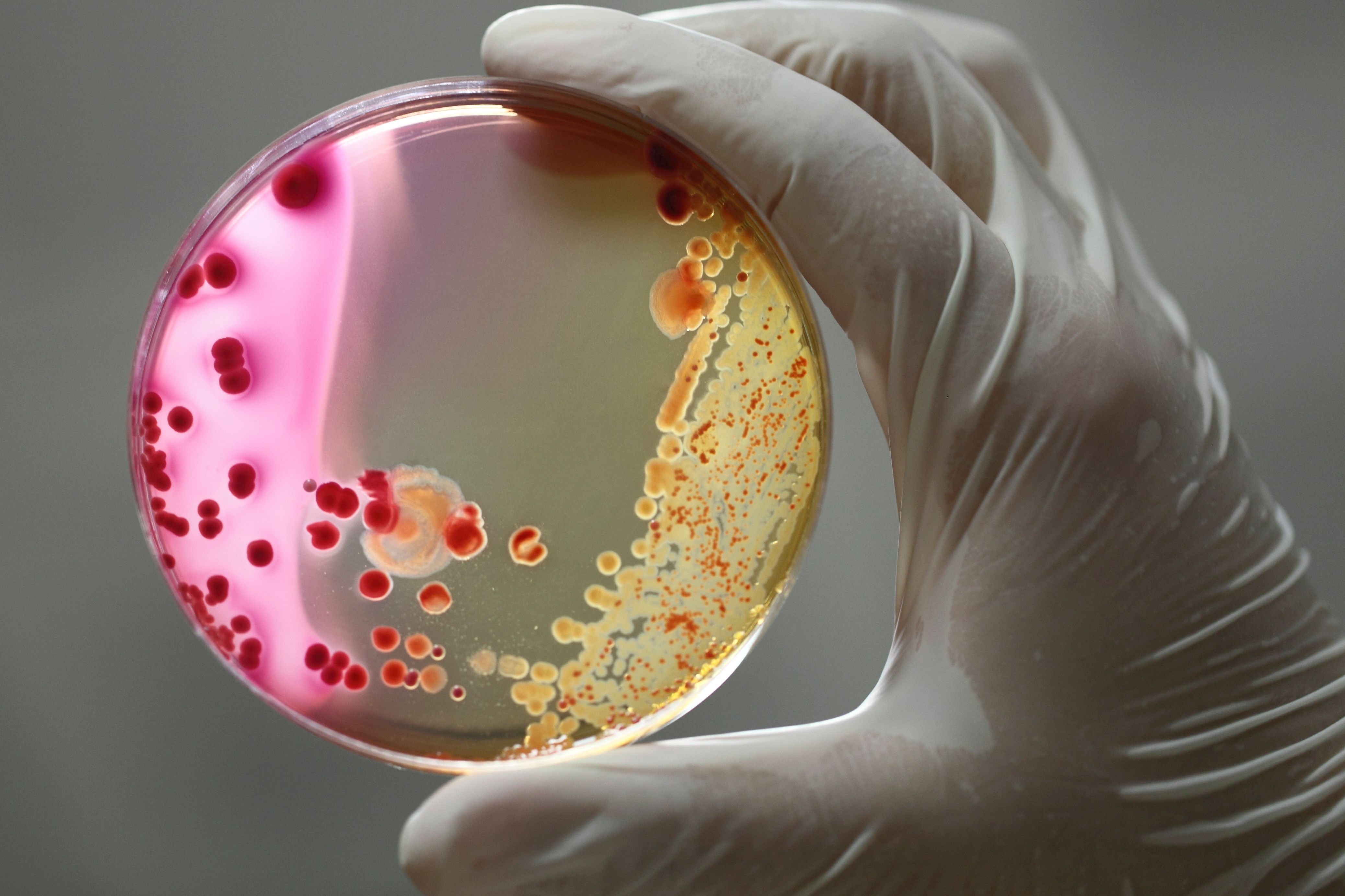 Bacteria -- Image credit: ridvanarda | stock.adobe.com