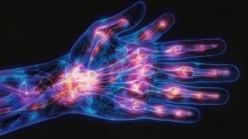 peripheral neuropathy, multiple myeloma