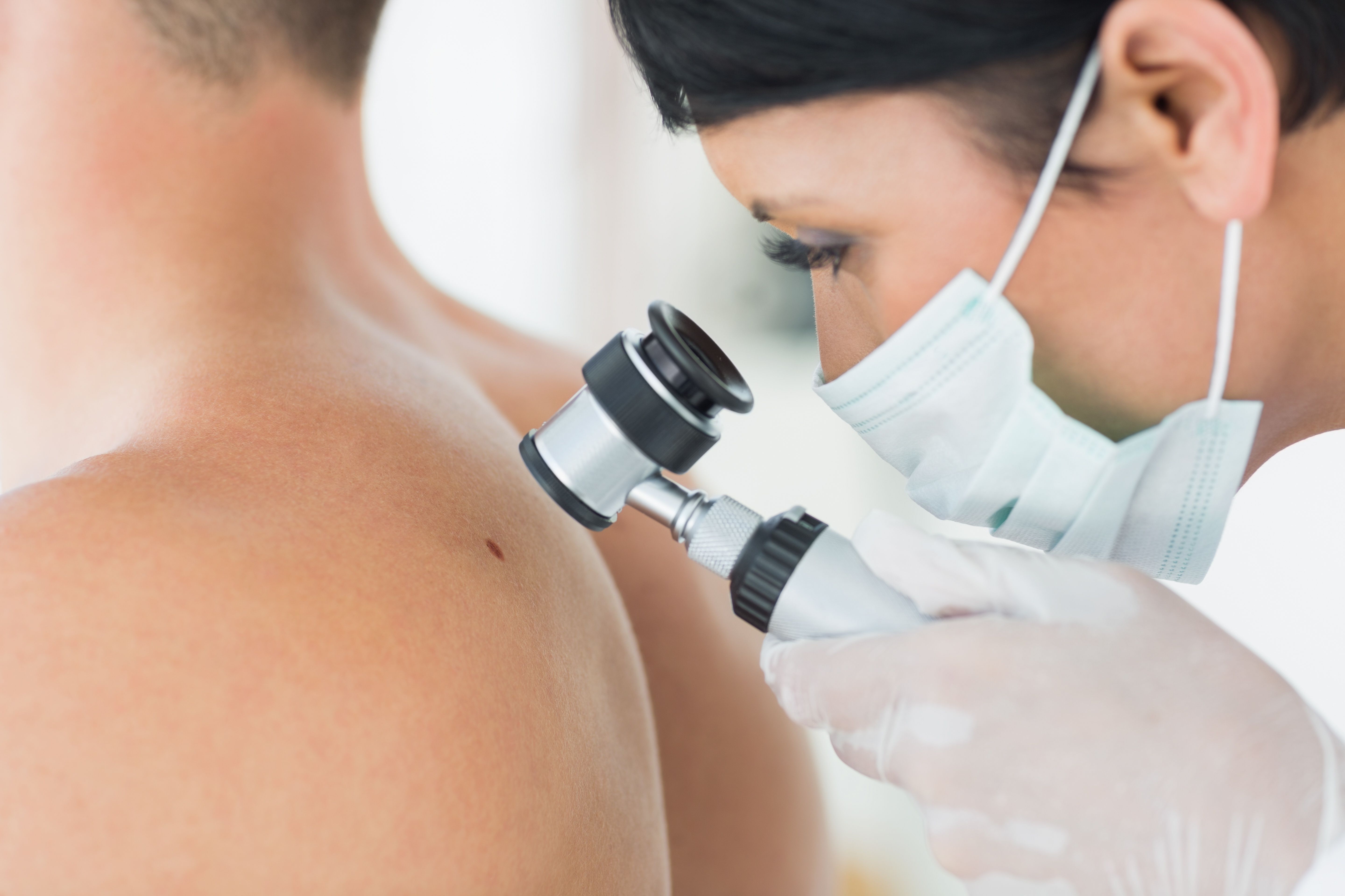 Health care professional examining a patient's mole