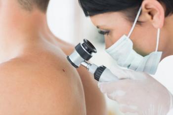 Health care professional examining a patient's mole