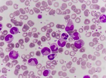 Leukemia blood cells medical science background concept.