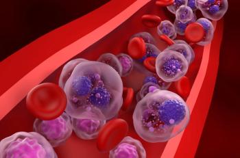 Multiple myeloma cells -- Image credit: LASZLO | stock.adobe.com