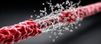 Hyperlipidemia concept showing artery with plaque buildup and blood flow disruption in detailed medical illustration.