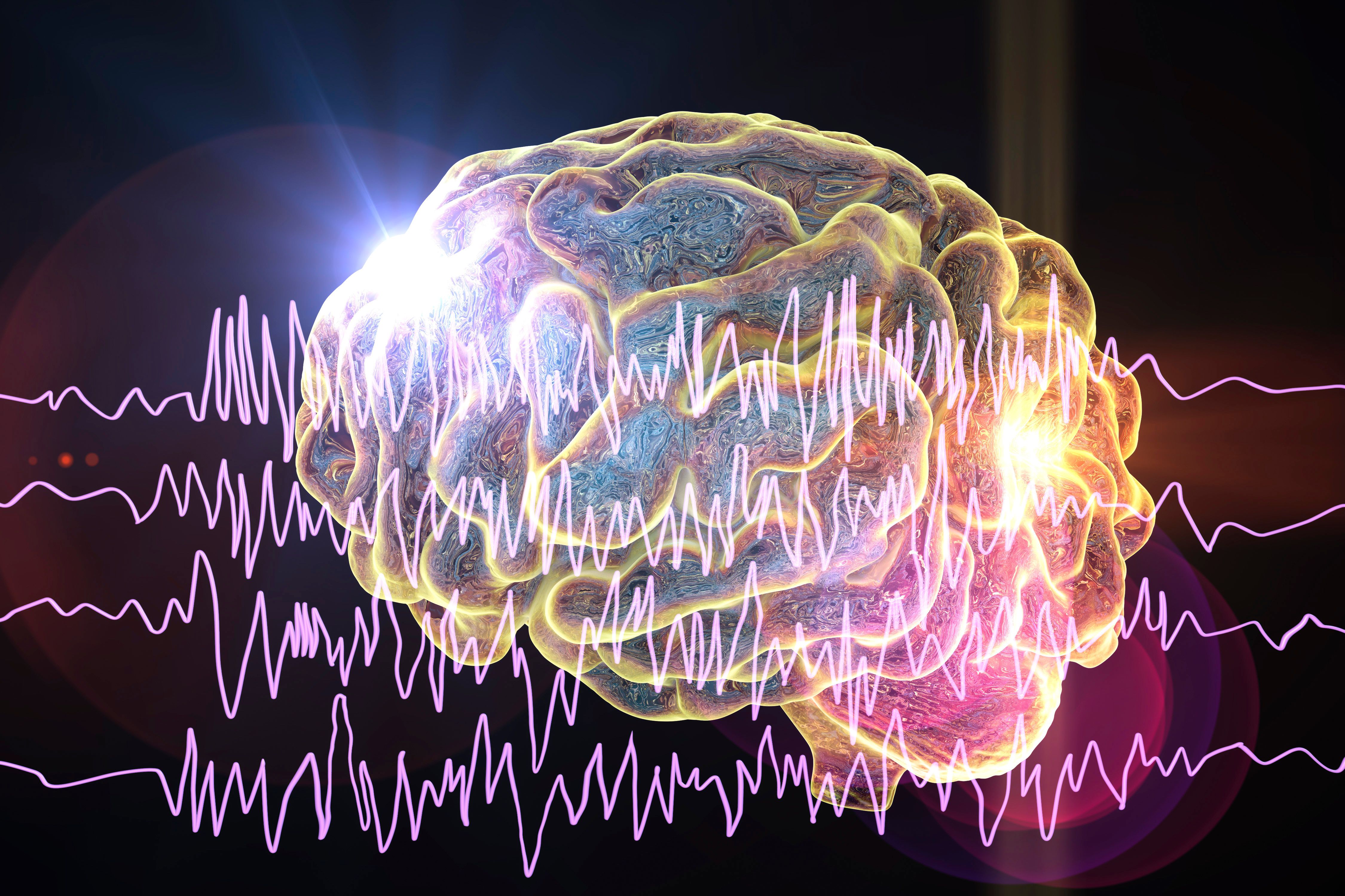 Brain showing signs of epilepsy -- Image credit: Dr_Microbe | stock.adobe.com