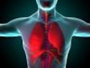 Atezolizumab Combo Approved for Frontline Treatment of Metastatic Non-Small Cell Lung Cancer