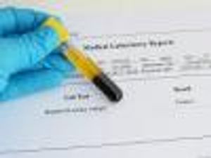 Hepatitis C Virus Enzyme Could Provide Novel Drug Target