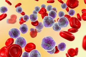 Obinutuzumab-Bendamustine Produces High Response Rates in Chinese Patients With Indolent B-Cell Lymphomas
