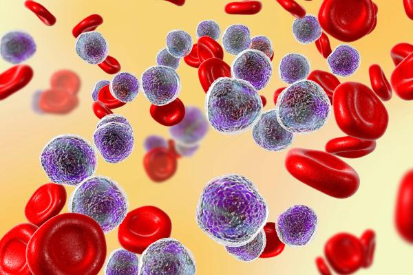 Obinutuzumab-Bendamustine Produces High Response Rates in Chinese Patients With Indolent B-Cell Lymphomas