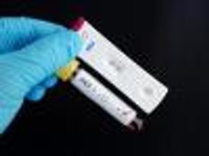 VA Data Could Prove Key in Assessing Real-World Efficacy of Hepatitis C Drugs