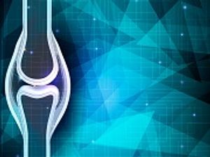 TBO-Filgrastim Offers Significant Cost Savings Over Filgrastim in Myeloma Treatment