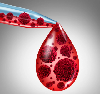 Pharmacist Medication Insights: Darzalex Faspro for Multiple Myeloma