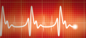 Atrial Fibrillation Patients Prescribed Digoxin Are More Likely to Die