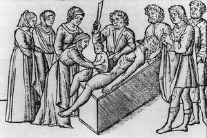 Why Chainsaws Were Originally Invented for Childbirth