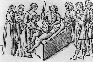 Why Chainsaws Were Originally Invented for Childbirth