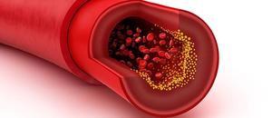 Do Statins Interfere With Clopidogrel During Platelet Therapy?