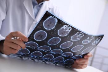 Health care professional looking at MRI scans of brain affected by multiple sclerosis (MS) -- Image credit: New Africa | stock.adobe.com