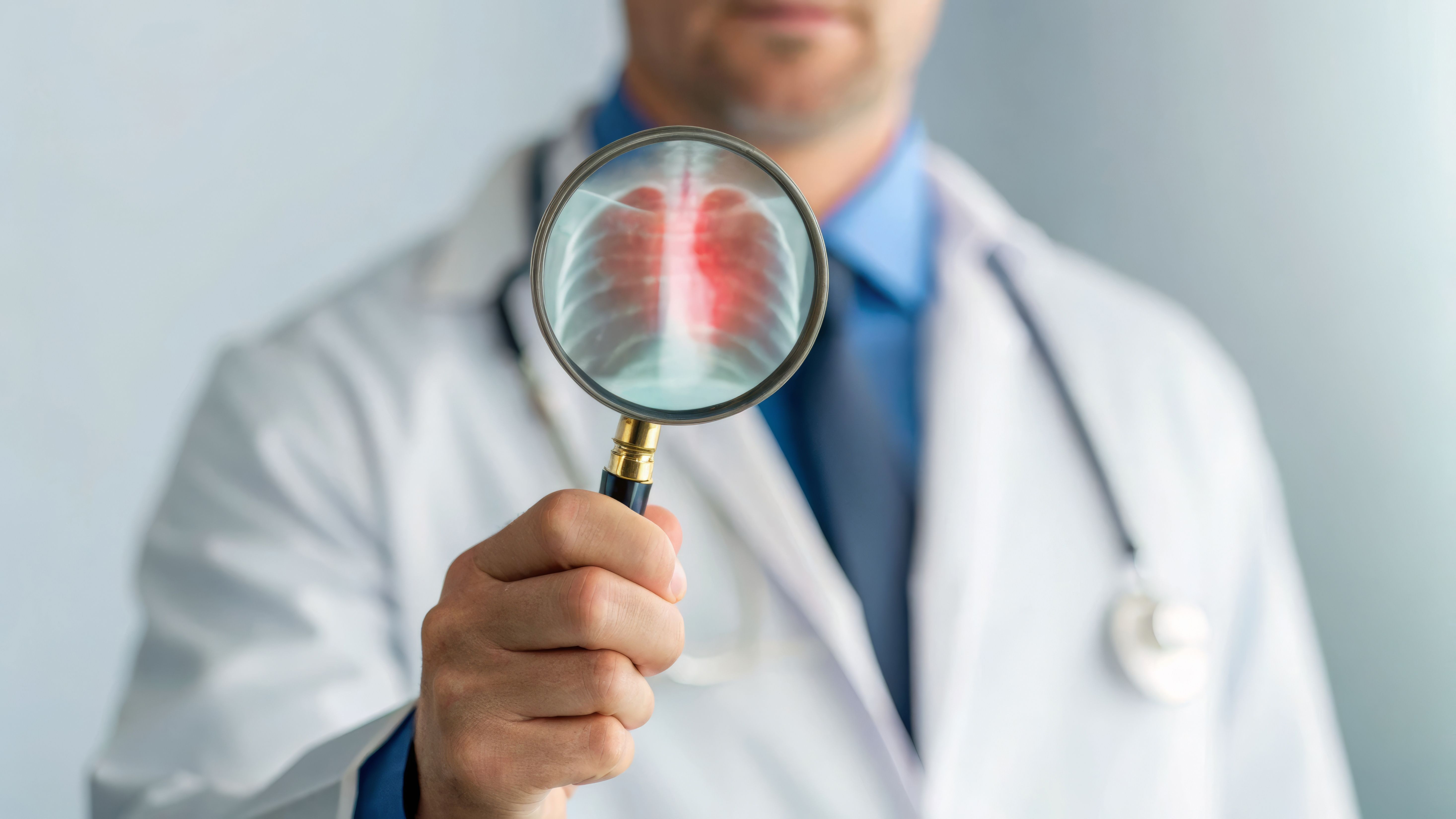 <![CDATA[Pharmacists Can Advance Lung Cancer Screening Awareness in High-Risk Patients ]]>