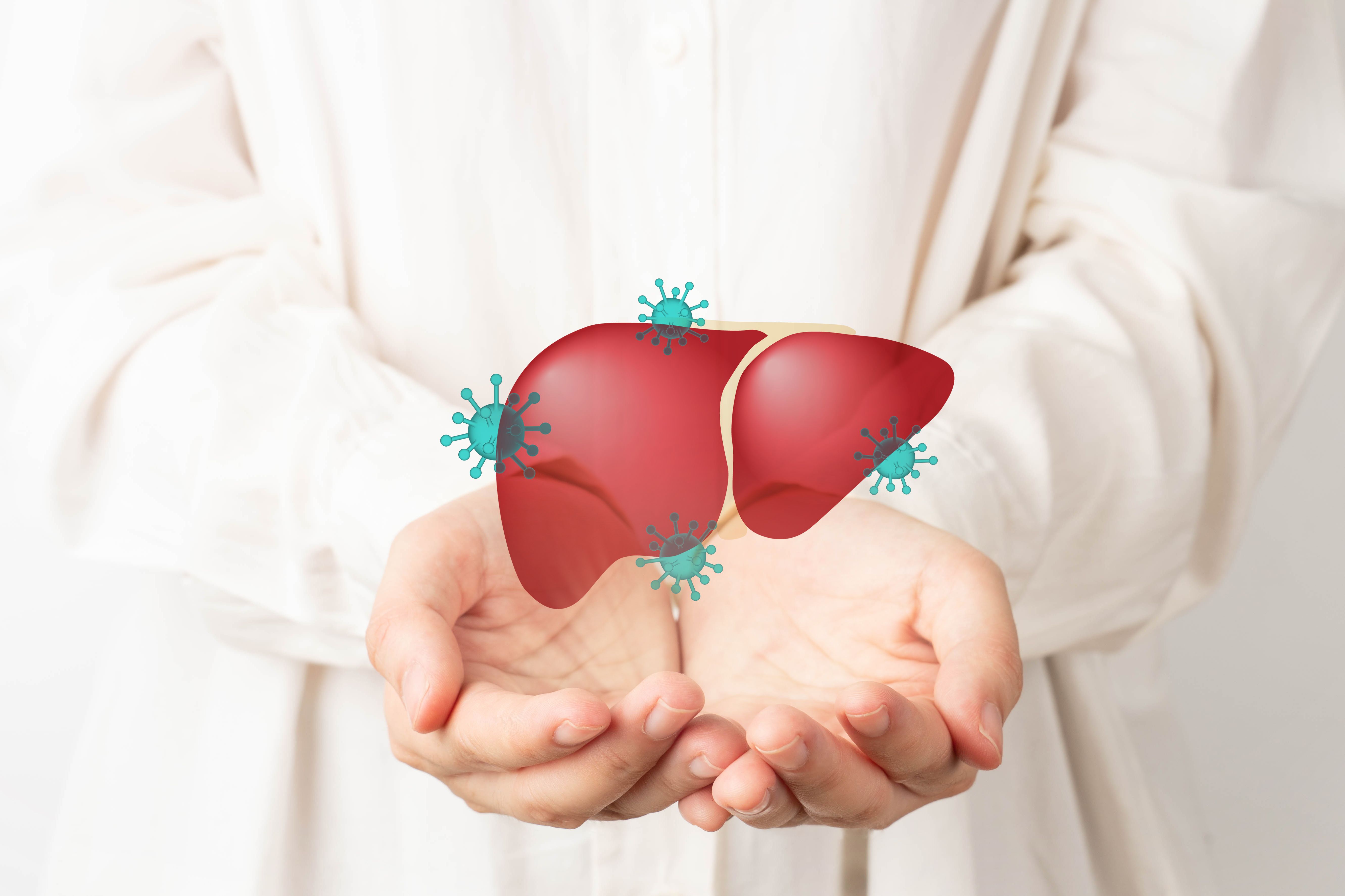 Liver impacted by chronic hepatitis B -- Image credit: © Orawan | stock.adobe.com