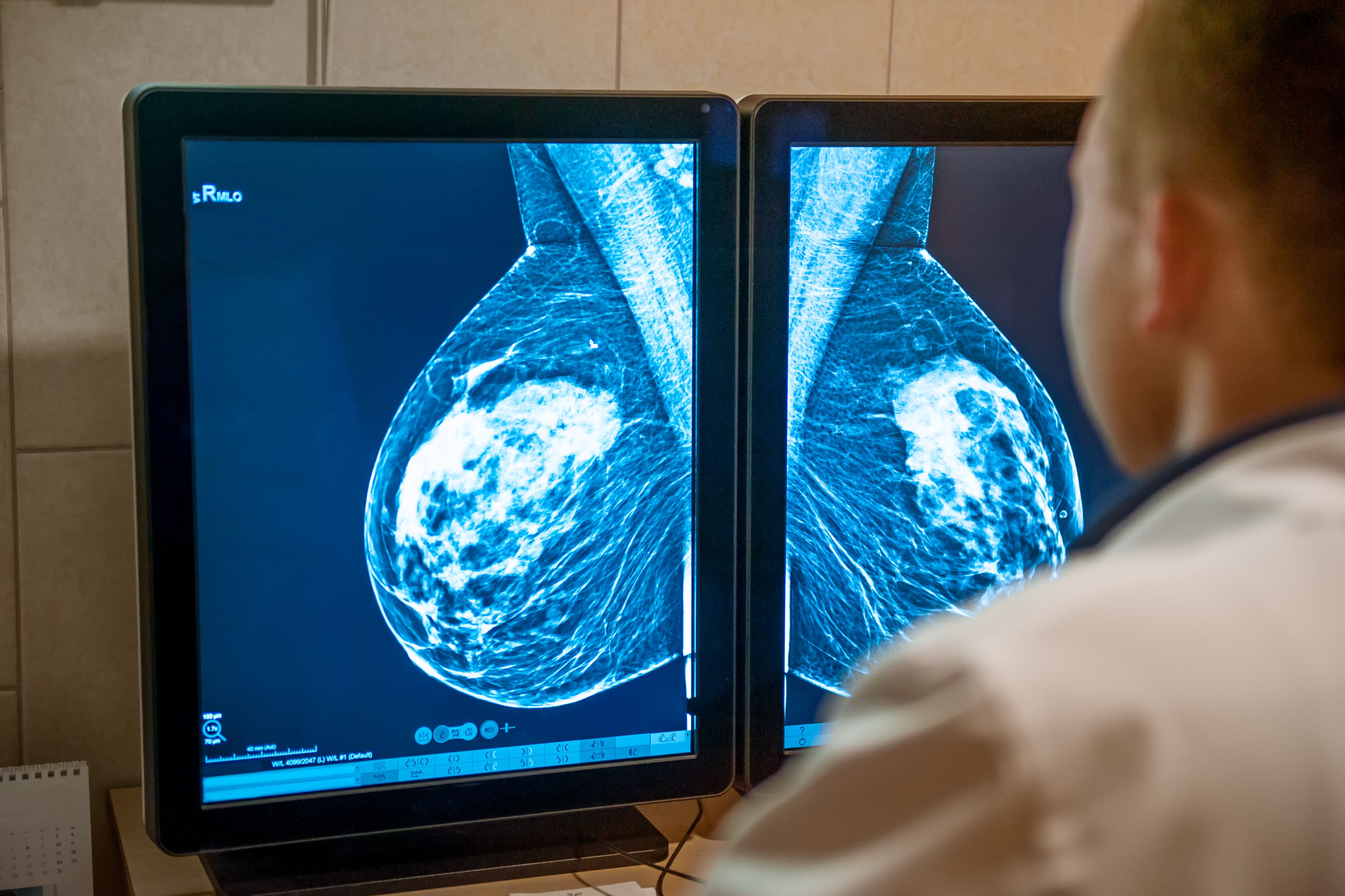Health care professional examining mammogram -- Image credit: okrasiuk | stock.adobe.com