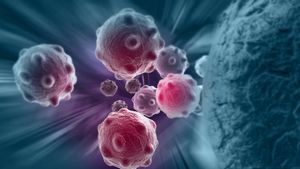 Early Screening Is Key in Colorectal Cancer