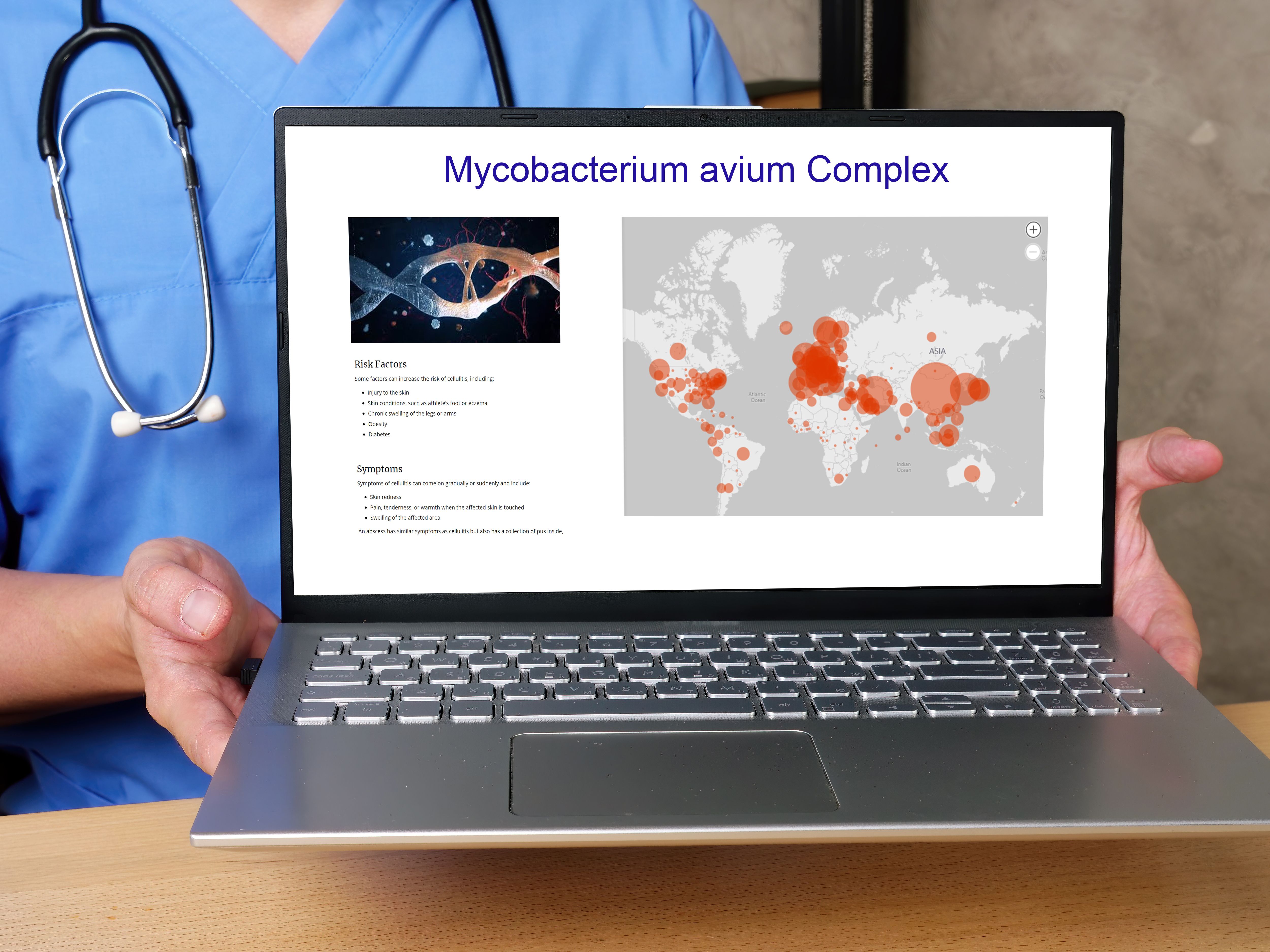 Pharmacist displaying global instances of mycobacterium avium complex on a laptop | Image Credit: © Yurii Kibalnik - stock.adobe.com