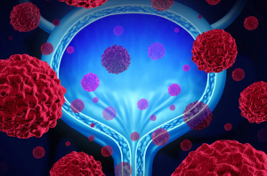 Novel Immunotherapies in Perioperative Setting in Muscle-Invasive Bladder Cancer May Transform Clinical Practice