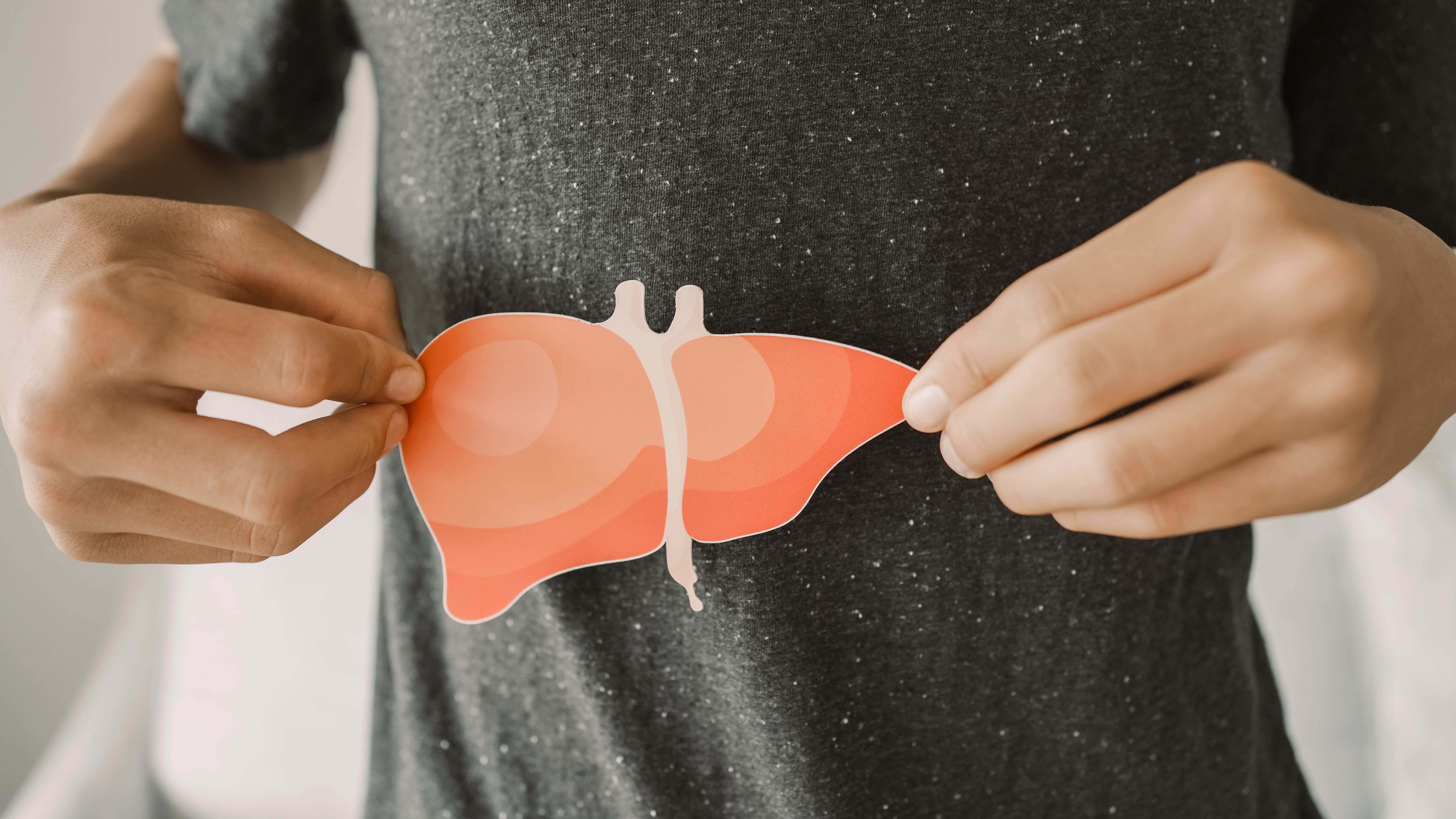 Survodutide Improves Liver Disease Progression in More than 80% of Patients with MASH