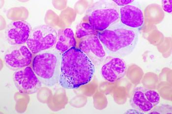 Chronic myeloid leukemia cells or CML, analyze by microscope