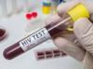 Spotlight on 'Informal' HIV Prevention Efforts