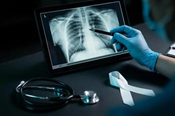 Radiologist Pointing at Chest X-Ray of Healthy Lungs, Stethoscope and White Ribbon on Desk, World Lung Cancer Day Early Detection | Image Credit: Sher | stock.adobe.com
