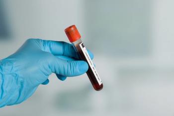 Gloved hand holding blood test sample | Image Credit: © StudioLaMagica - stock.adobe.com